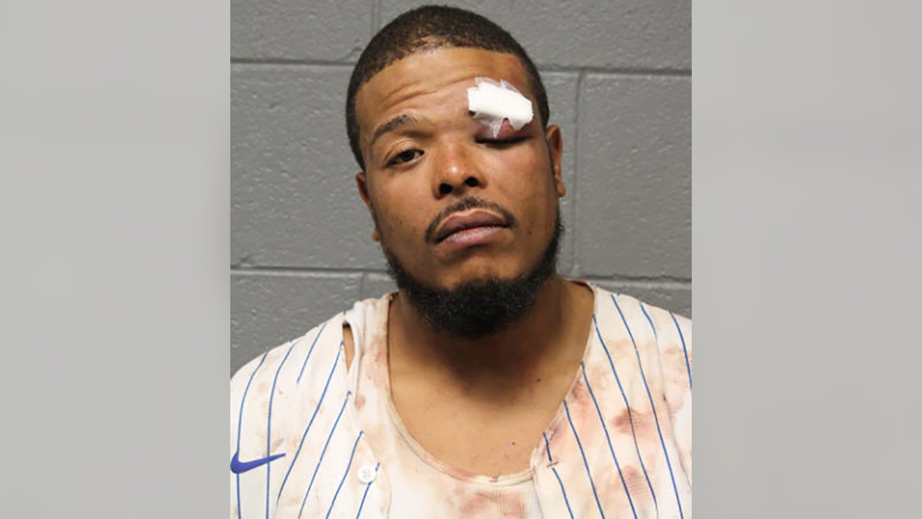 Man Beats off-duty Chicago Police Officer, Bites off Friend’s Nipple in Road Rage incident