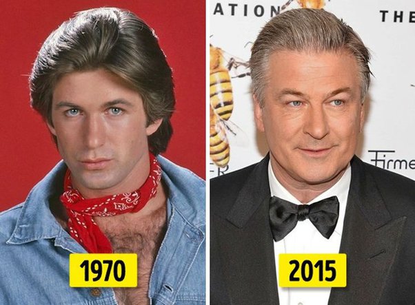 Which Actor Changed a Lot Over the Years and Had Their Appearance Transformed?