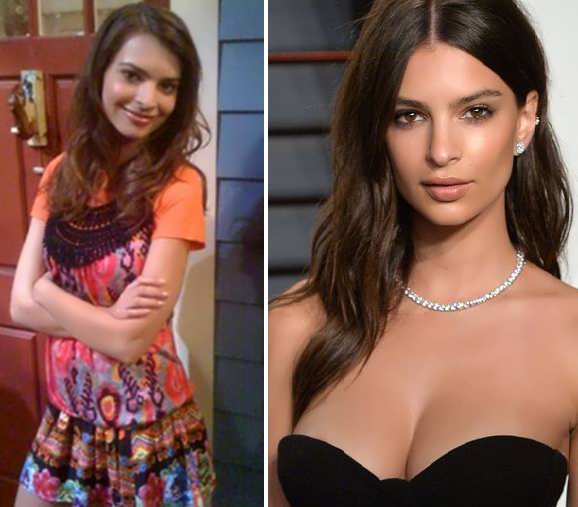 Emily Ratajkowski Plastic Surgery Fact or Rumor