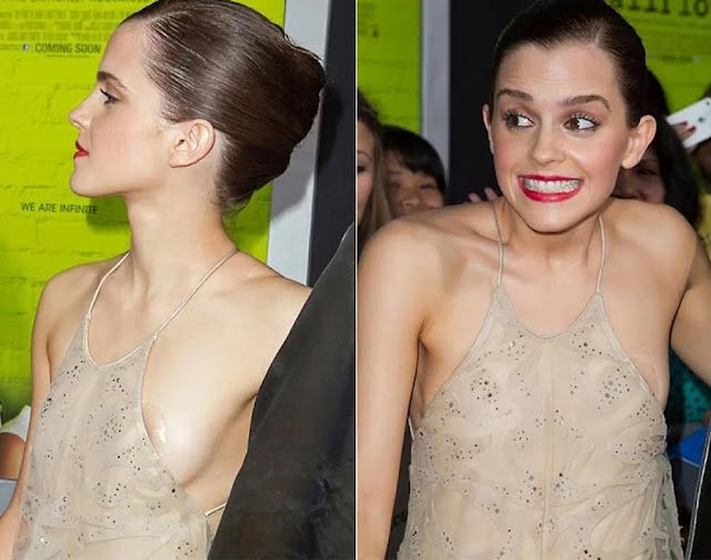Uneasy Photos of Celebrities That Will Make You See Them With Different Eyes