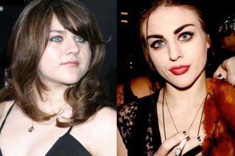 Frances Bean Cobain Plastic Surgery Before and After