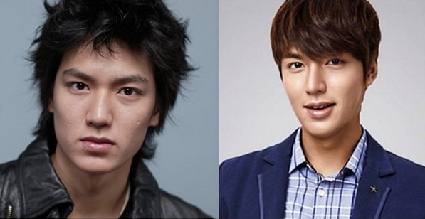 Lee Min Ho Plastic Surgery Before and After Pictures