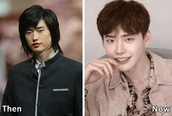 Pinocchio Actor, Lee Jong Suk Plastic Surgery