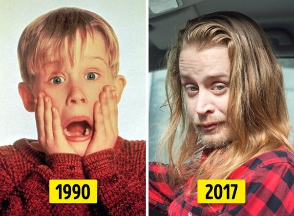 Which Actor Changed a Lot Over the Years and Had Their Appearance Transformed?