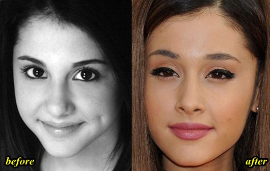 ariana-grande-plastic-surgery-before-1146253429.jpeg