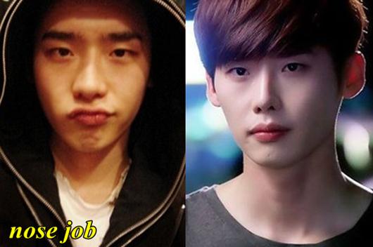 Pinocchio Actor, Lee Jong Suk Plastic Surgery