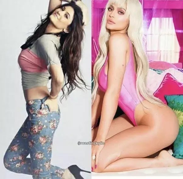 Has Kylie Jenner Had Plastic Surgery?