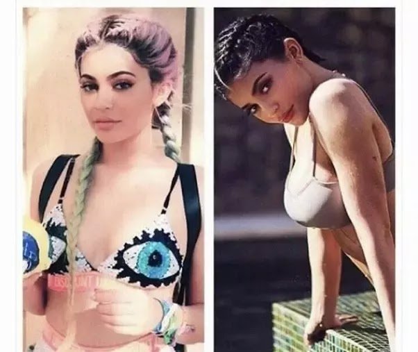 Has Kylie Jenner Had Plastic Surgery?