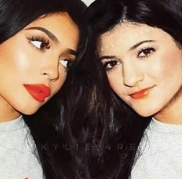 Has Kylie Jenner Had Plastic Surgery?