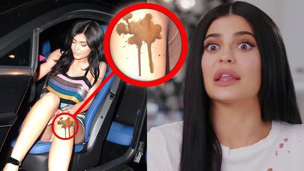 Photos: What Are Some Of Kylie Jenner's “Oops” Moments?