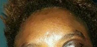 Man Allegedly Beats His Wife To Pulp, Dumps Her Over Disagreement With His Girlfriend In Rivers (Photos) Man Allegedly Beats His Wife To Pulp, Dumps Her Over Disagreement With His Girlfriend In Rivers (Photos)