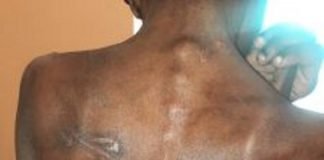 Police rescue 17-year-old girl allegedly starved, brutalised and locked up by her aunt in Plateau Police rescue 17-year-old girl allegedly starved, brutalised and locked up by her aunt in Plateau