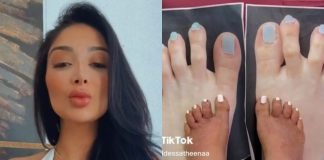 Woman who didn’t like her long toes is mocked after getting toe-shortening surgery that looks worse Woman who didn't like her long toes is mocked after getting toe-shortening surgery that looks worse