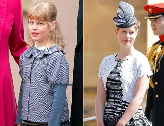 Lady Louise before and after eye surgery