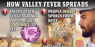 Valley Fever: Deadly fungal infection is spreading fast across the US
