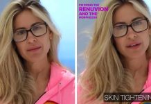 Kim Zolciak, 45, reveals she’s getting laser vaginal rejuvenation ‘to stop her PEEING whenever running or sneezing’