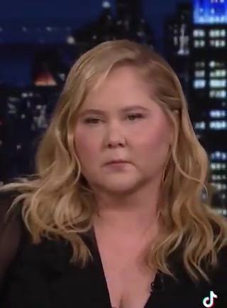 Amy Schumer breaks silence on her SWOLLEN face after sparking concern