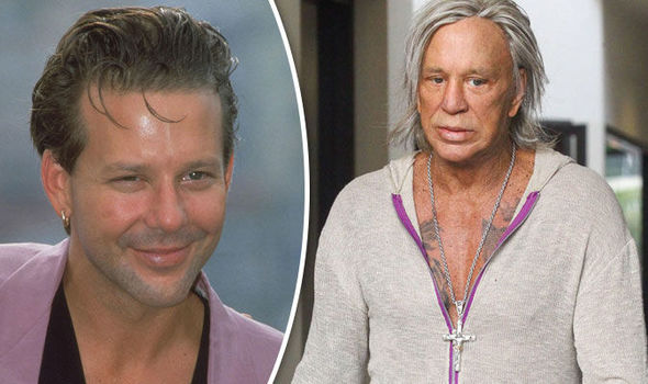 From Nightmare to Filler: Top 15 Celebrity Plastic Surgery That Made Us Wince
