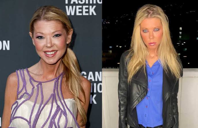 From Nightmare to Filler: Top 15 Celebrity Plastic Surgery That Made Us Wince