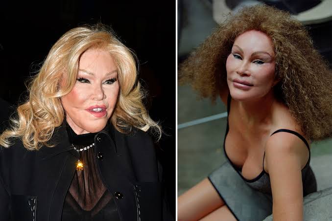 From Nightmare to Filler: Top 15 Celebrity Plastic Surgery That Made Us Wince