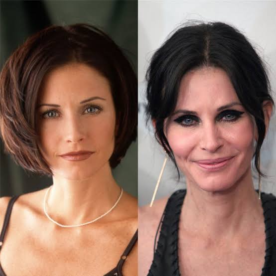 From Nightmare to Filler: Top 15 Celebrity Plastic Surgery That Made Us Wince