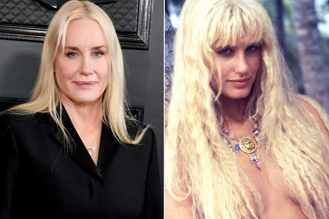 From Nightmare to Filler: Top 15 Celebrity Plastic Surgery That Made Us Wince
