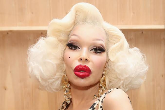 From Nightmare to Filler: Top 15 Celebrity Plastic Surgery That Made Us Wince