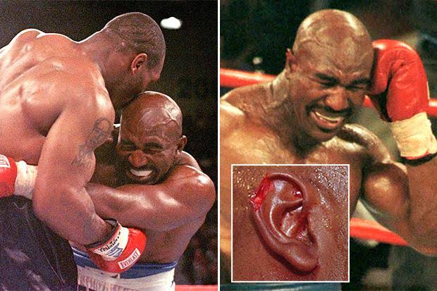 13 Unsportsmanlike Moments in Professional Sports