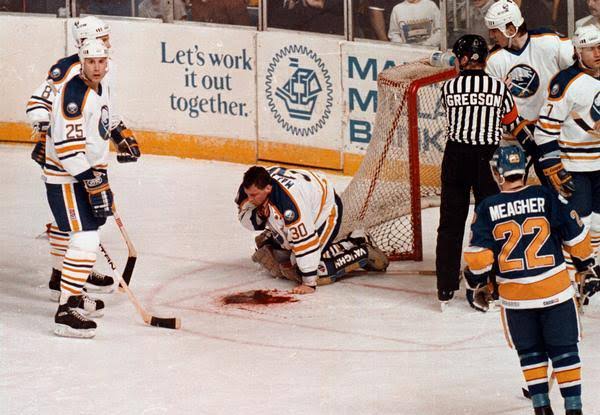 The Agony of Victory: Top 13 Horrific Sports Injuries