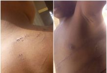 Nasarawa State: 4-Year-Old Orphan Allegedly Brutalized By Uncle For Dancing At Naming Ceremony