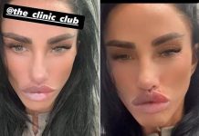 Katie Price shows off BIGGEST lips yet and even tighter face after new £10k surgery work