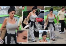 Katie Price shows a painful-looking EYE injury and extreme weight loss