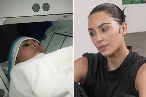 Kim Kardashian says surgeon told her brain aneurysm could rupture at any time due to her lifestyle