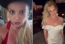 Britney Spears underwent BOTCHED Botox procedure that left her eye droopy for weeks